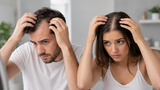 Hair Loss: Causes, Treatments, and Evidence-Based Solutions for Men and Women